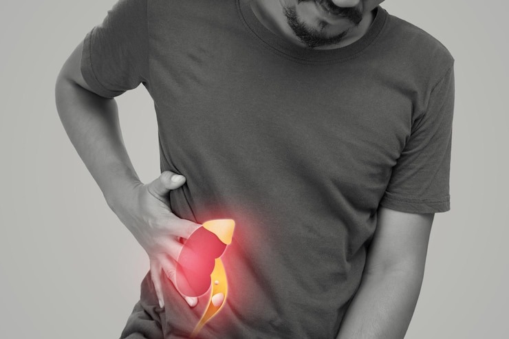 Consider Ayurvedic treatment to treat kidney stones