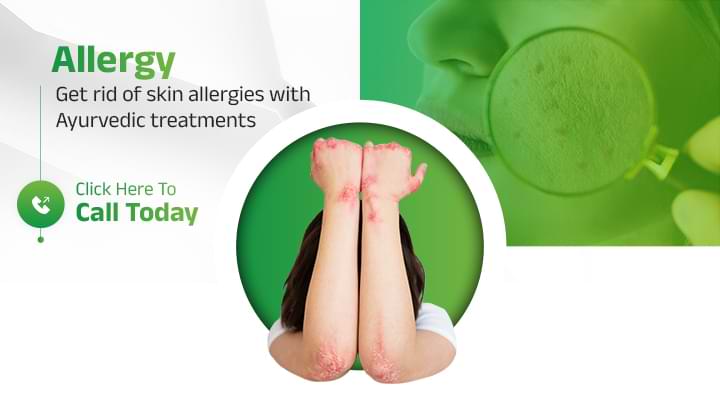 Get Rid of Skin Allergies